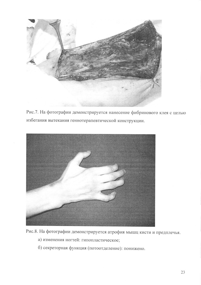 Способ индукции регенерации периферического нерва (патент 2639175)