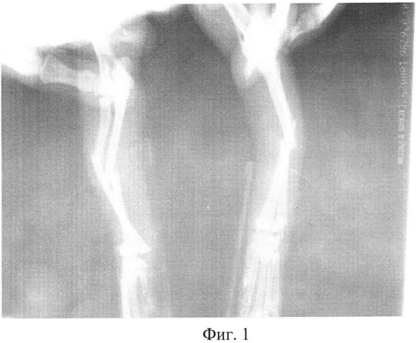 Способ лечения переломов у животных (патент 2529697)