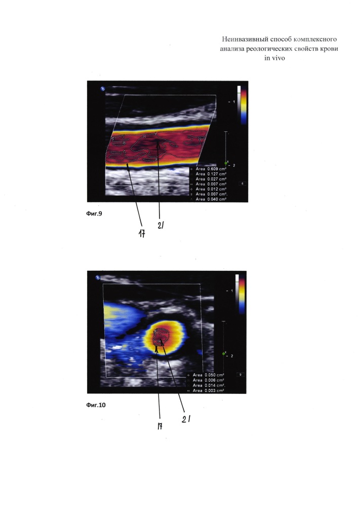 Неинвазивный способ комплексного анализа реологических свойств крови in vivo (патент 2625281)
