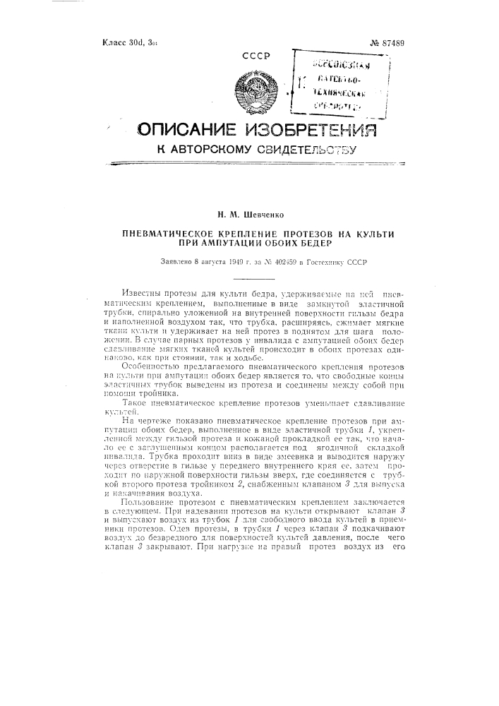 Пневматическое крепление протезов на культи при ампутации обоих бедер (патент 87489)