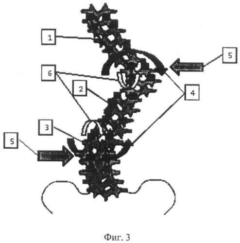 Способ коррекции деформации позвоночника (патент 2506919)