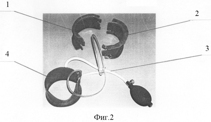 Устройство ручного доступа при лапароскопических операциях и способ его использования (патент 2324436)