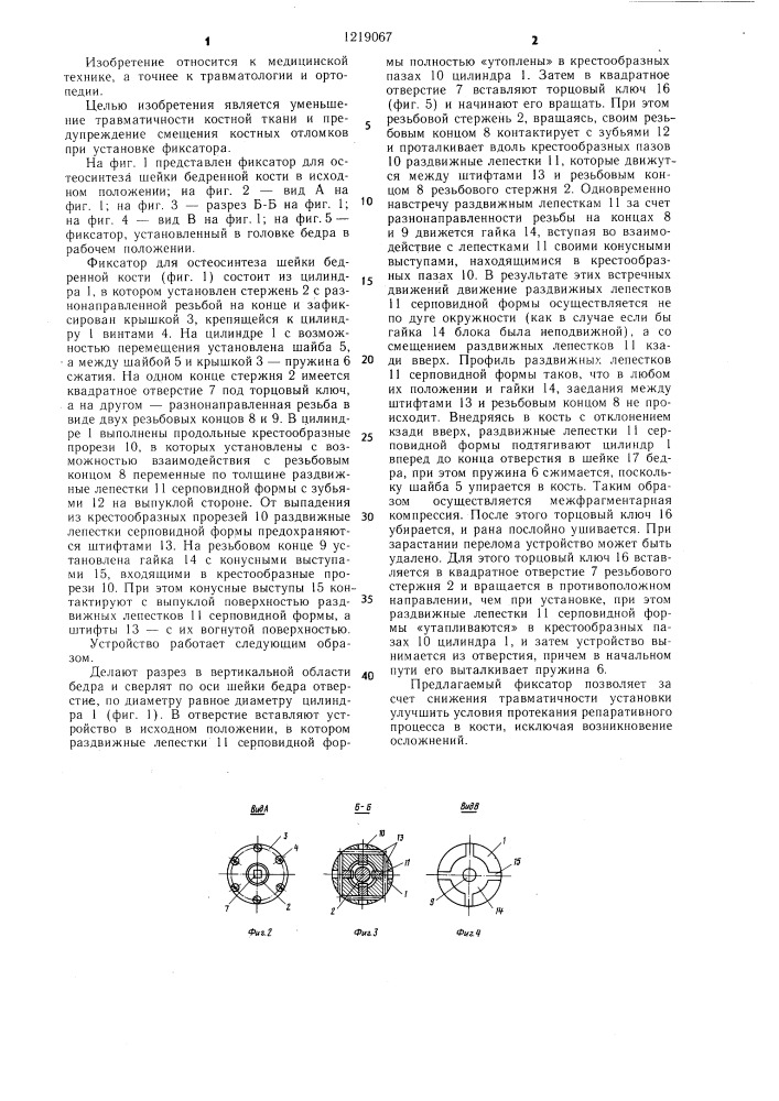 Фиксатор для остеосинтеза шейки бедренной кости (патент 1219067)