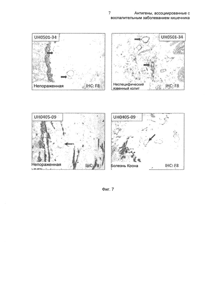 Антигены, ассоциированные с воспалительным заболеванием кишечника (патент 2612878)