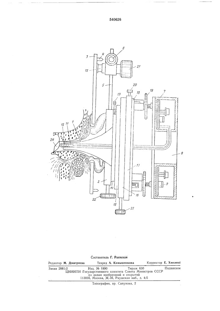 Устройство для исследования колебаний барабанной перепонки и звукопроводящего аппарата среднего уха человека (патент 540626)