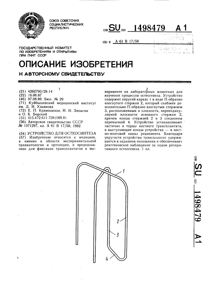 Устройство для остеосинтеза (патент 1498479)