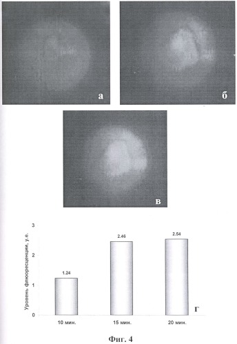 Способ флюоресцентной диагностики в ходе фотодинамической терапии глазных заболеваний (патент 2411901)