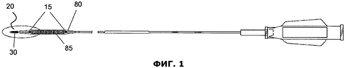 Наконечник катетера с пружиной (патент 2531345)