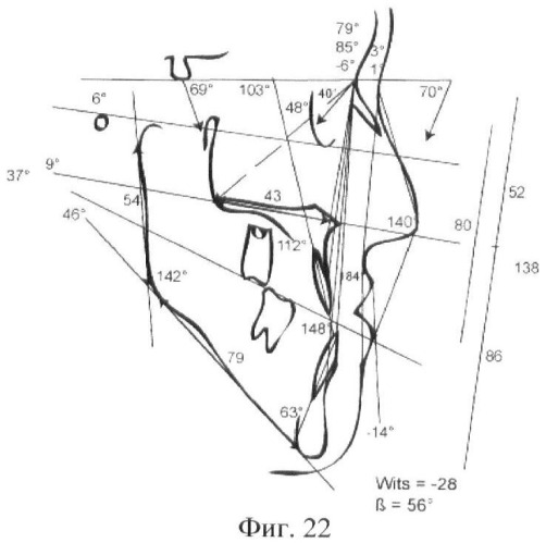 Способ объективной оценки результатов ортодонтического лечения (патент 2444292)