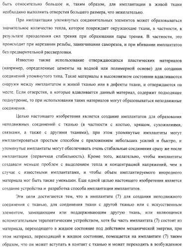 Имплантаты для создания соединений с тканями, в частности со скелетом, а также устройство и способ имплантации (патент 2314768)