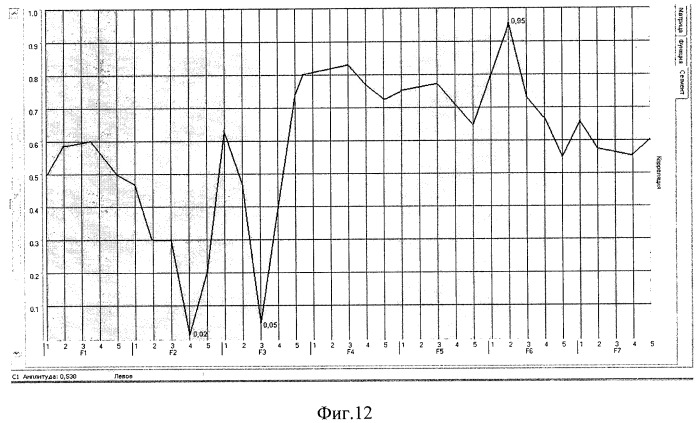 Способ диагностики заболеваний глаза (патент 2521347)