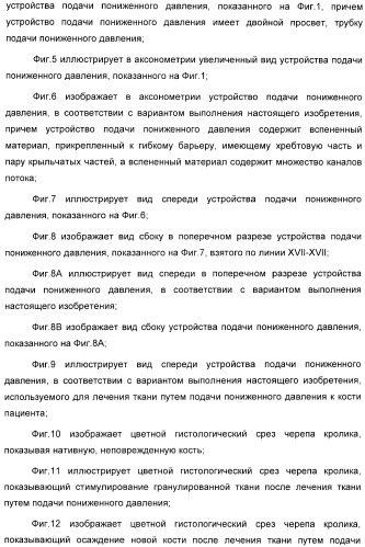 Устройство для лечения путем подкожной подачи пониженного давления с использованием разделения с помощью воздушного баллона (патент 2401652)