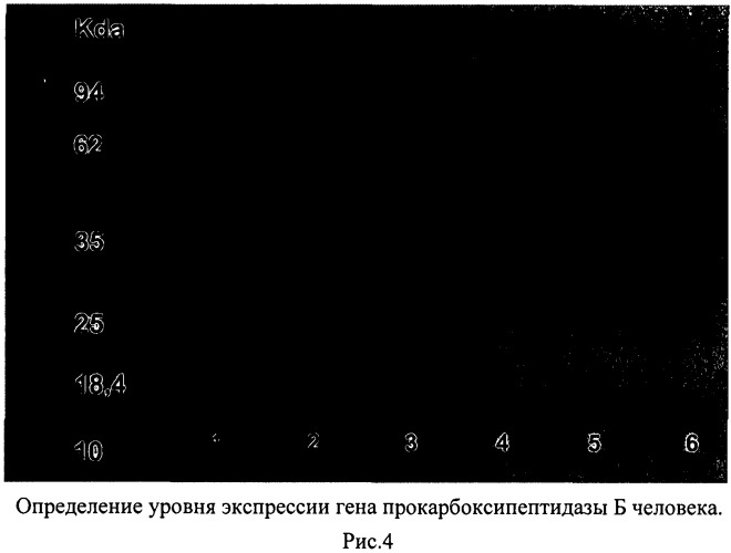 Рекомбинантная плазмидная днк pcpbh для биосинтеза полипептида со свойствами карбоксипептидазы б человека, и рекомбинантный штамм метилотрофных дрожжей pichia pastoris - продуцент полипептида со свойствами карбоксипептидазы б человека (патент 2531524)