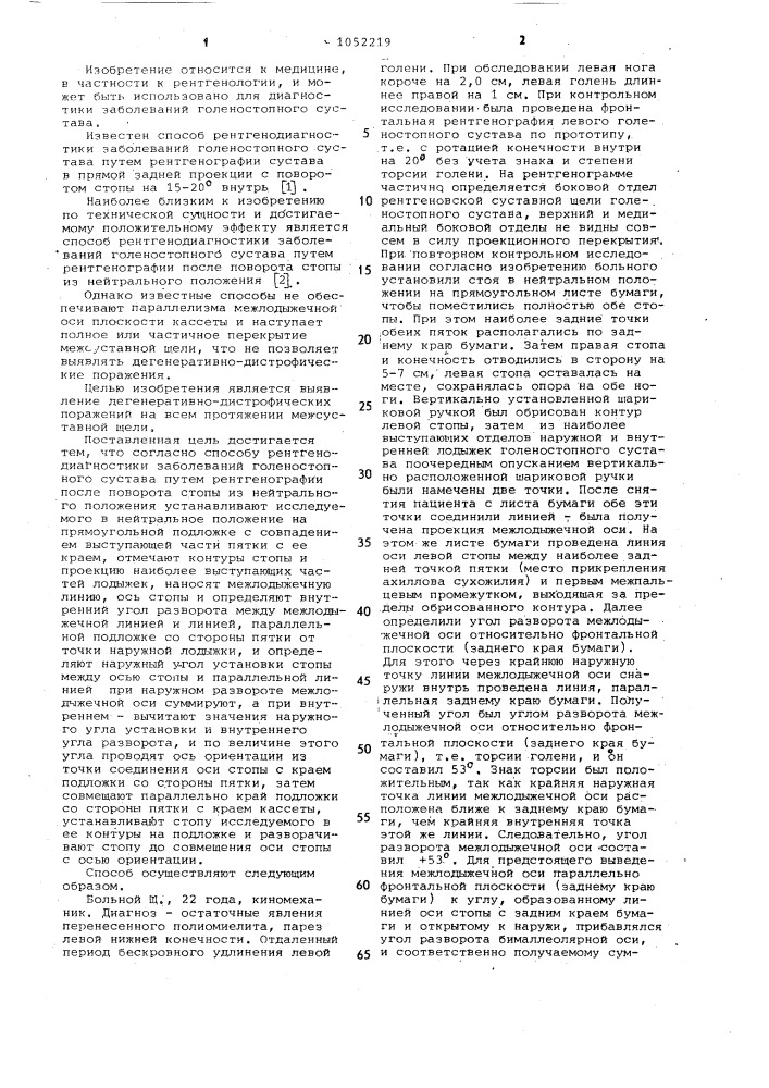 Способ рентгенодиагностики заболеваний голеностопного сустава (патент 1052219)