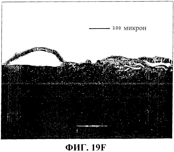 Застежки на основе пеноматериала (патент 2376915)