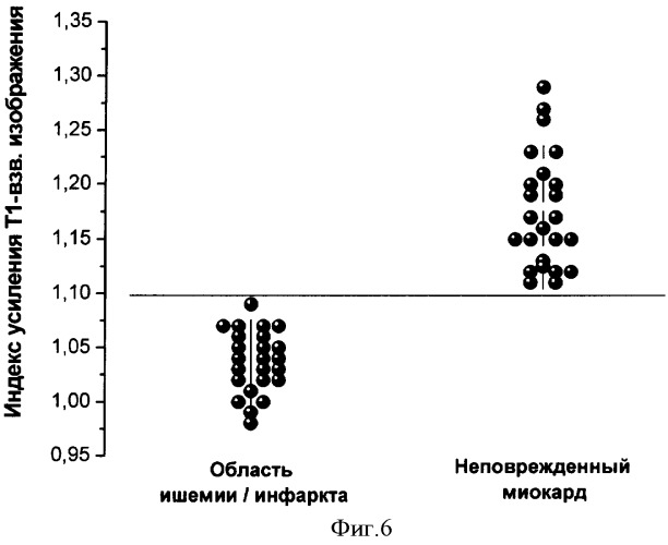 Способ магнитно-резонансной томографической диагностики ишемических нарушений коронарного кровообращения (патент 2330609)