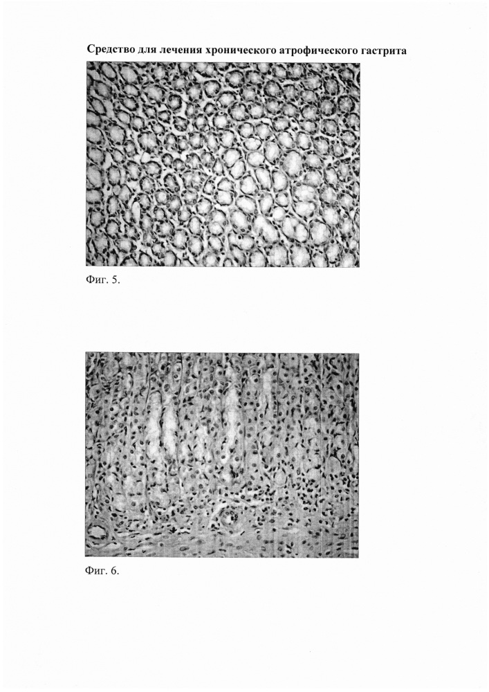 Средство для лечения хронического атрофического гастрита (патент 2662077)