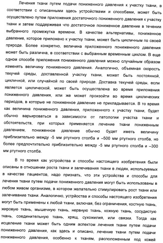 Система и способ продувки устройства пониженного давления во время лечения путем подачи пониженного давления (патент 2404822)