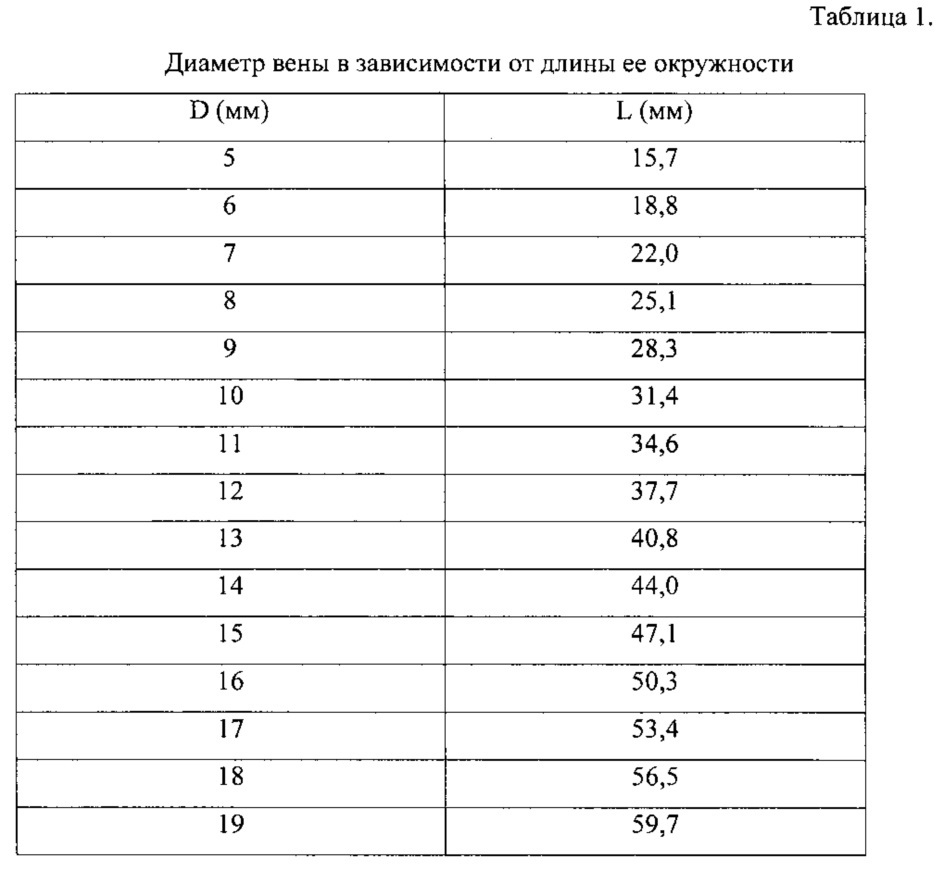 Способ пластики глубоких вен (патент 2612258)