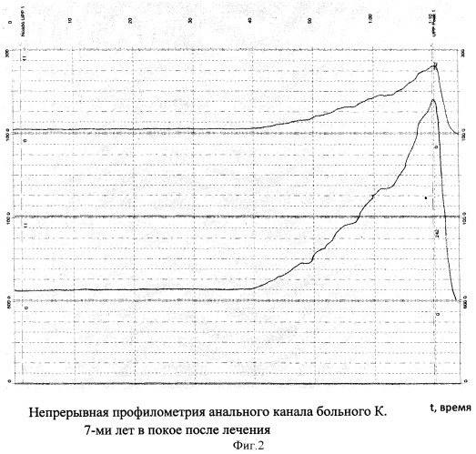 Способ лечения анального недержания у детей (патент 2406547)