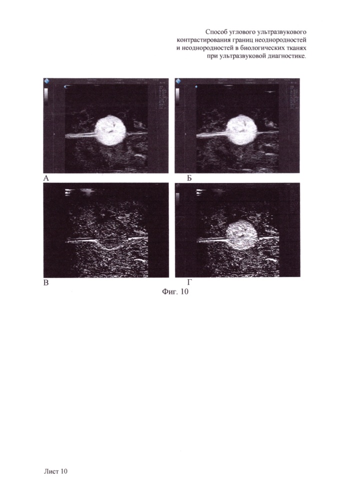 Способ углового ультразвукового контрастирования границ неоднородностей и неоднородностей в биологических тканях при ультразвуковой диагностике (патент 2648880)