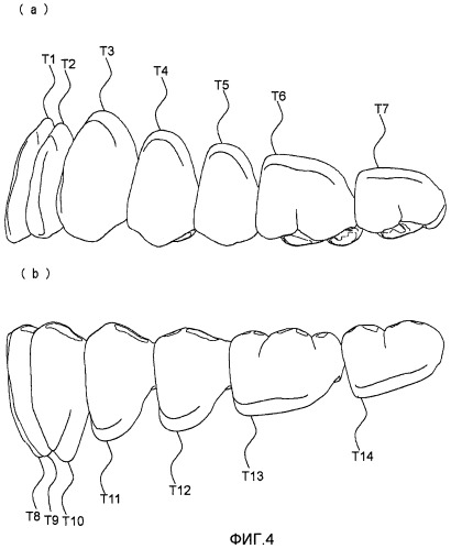 Искусственные зубы, позволяющие легко достигнуть двухсторонней сбалансированной окклюзии (патент 2456956)