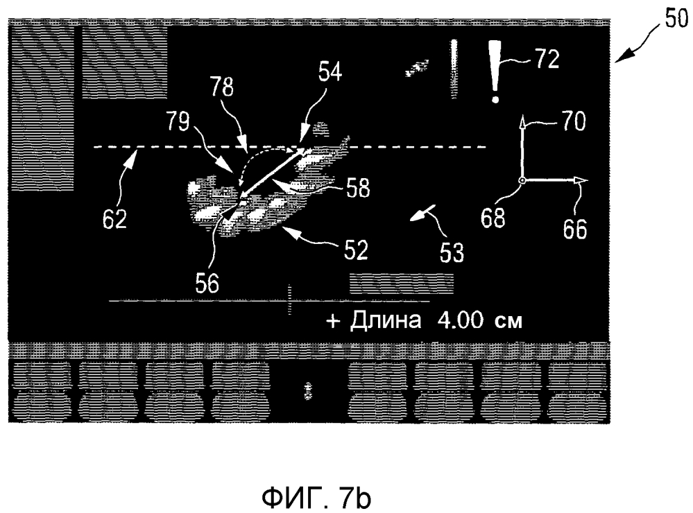 Система и способ трехмерных ультразвуковых измерений объемных областей (патент 2620865)