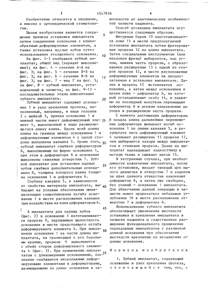 Зубной имплантат и способ его установки (патент 1547816)
