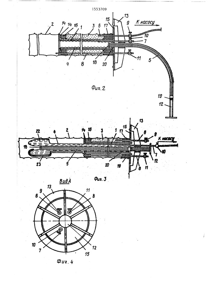 Напрягаемый анкер (патент 1553709)