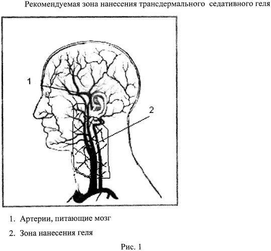 Трансдермальный седативный фармацевтический гель для лечения психоэмоциальных расстройств (патент 2560668)