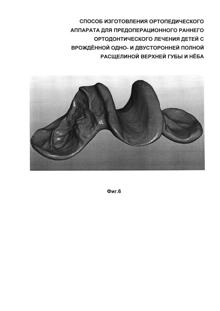 Способ изготовления ортопедического аппарата для предоперационного раннего ортодонтического лечения детей с врождённой одно- и двусторонней полной расщелиной верхней губы и нёба (патент 2599373)