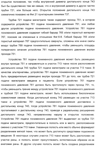 Система и способ продувки устройства пониженного давления во время лечения путем подачи пониженного давления (патент 2404822)