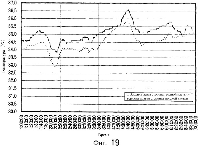Система контроля биологической информации (патент 2336808)