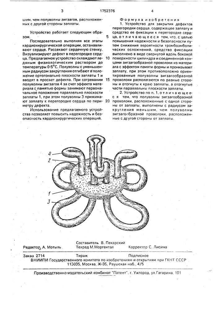 Устройство для закрытия дефектов перегородки сердца (патент 1752376)