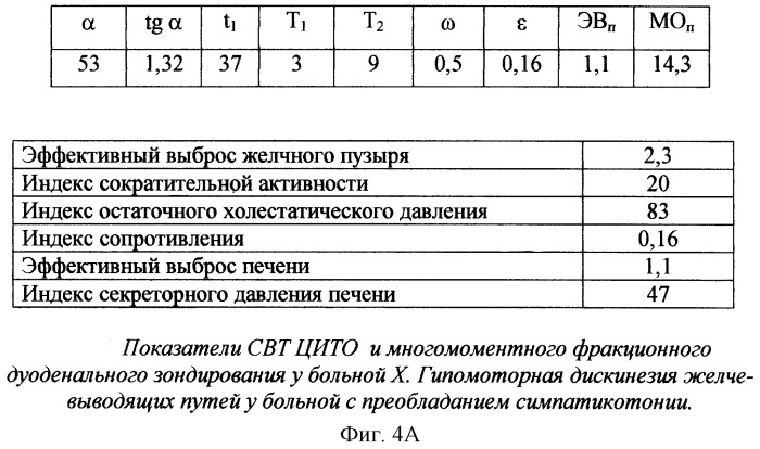 Способ диагностики дискинезии желчевыводящих путей (патент 2269292)