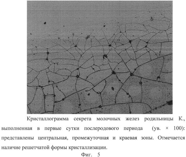 Способ прогнозирования ранней гипогалактии (патент 2563136)