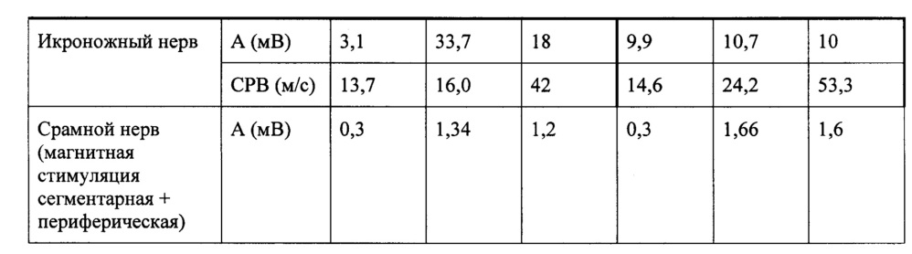 Способ восстановления функции нервов (патент 2662657)