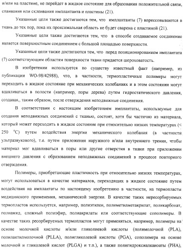 Имплантаты для создания соединений с тканями, в частности со скелетом, а также устройство и способ имплантации (патент 2314768)