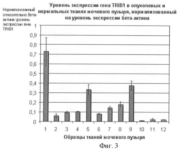 Способ диагностики рака мочевого пузыря (варианты) и набор для его осуществления (патент 2469323)