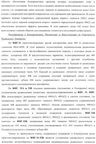 Стент из скользящих и блокирующих элементов (патент 2429801)
