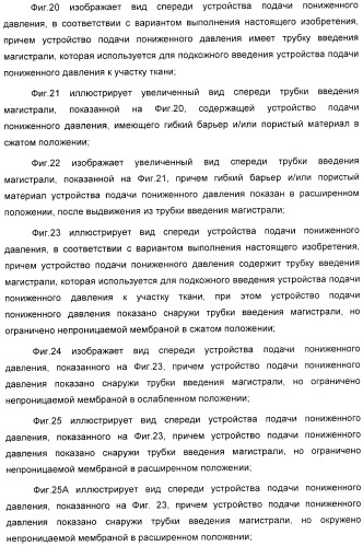 Система и способ продувки устройства пониженного давления во время лечения путем подачи пониженного давления (патент 2404822)