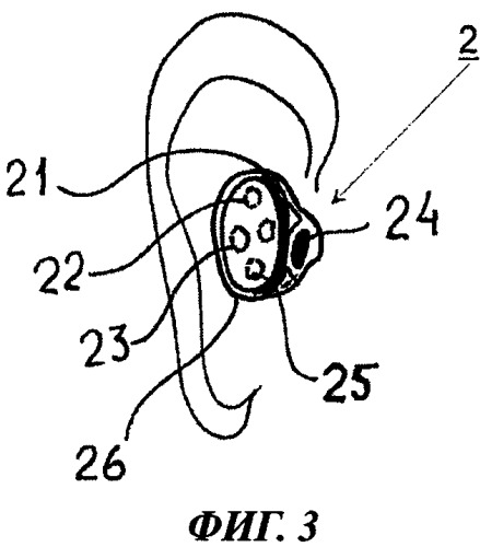 Способ и устройство для беспроводной генерации звука в ушной раковине (патент 2454019)