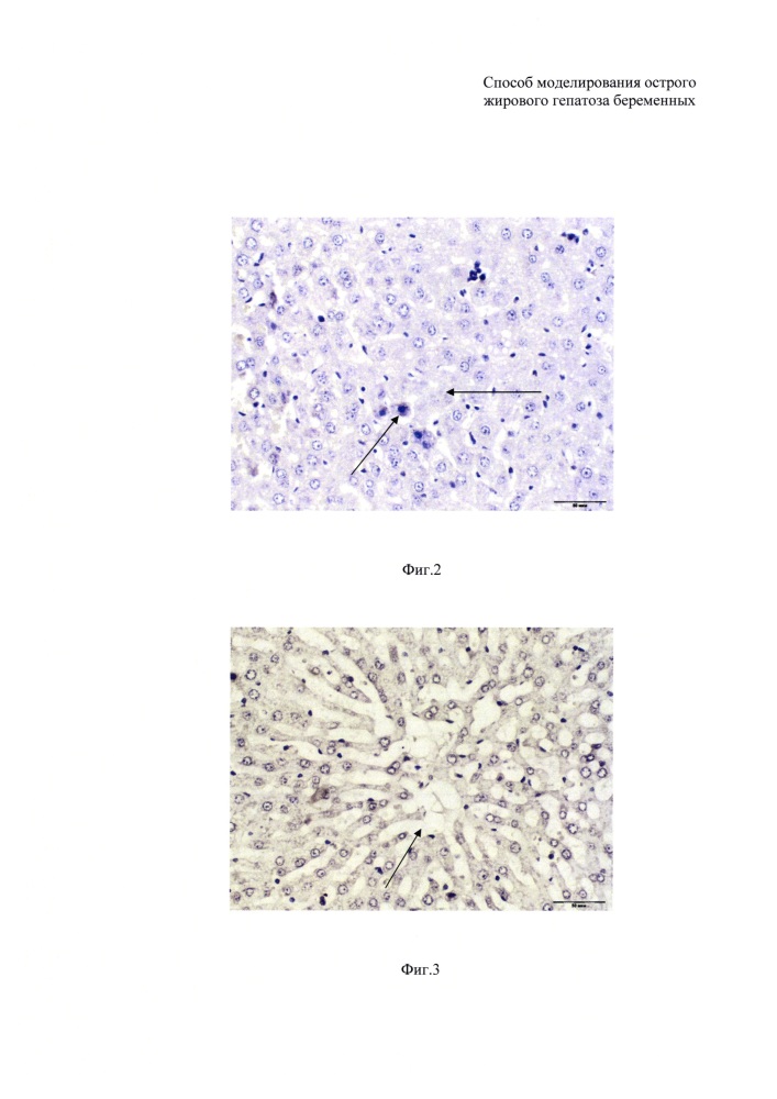 Способ моделирования острого жирового гепатоза беременных (патент 2610536)