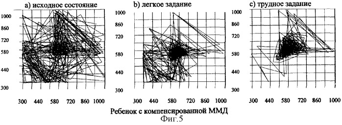 Способ диагностики состояния цнс (патент 2313277)