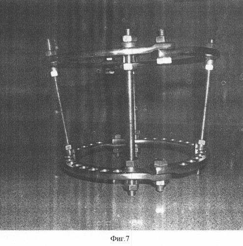 Аппарат внешней фиксации для интраоперационной репозиции и стабилизации положения посттравматических отломков костей (патент 2314767)