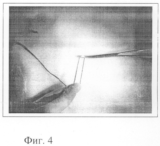 Способ наложения лигатуры (патент 2246269)