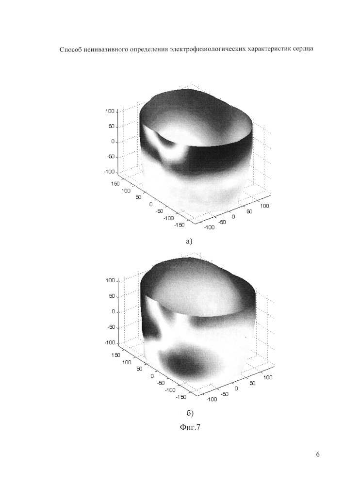 Способ неинвазивного определения электрофизиологических характеристик сердца (патент 2651068)