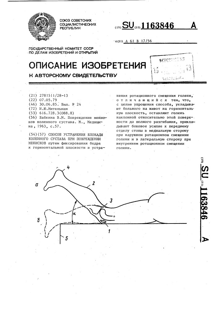 Способ устранения блокады коленного сустава при повреждении менисков (патент 1163846)