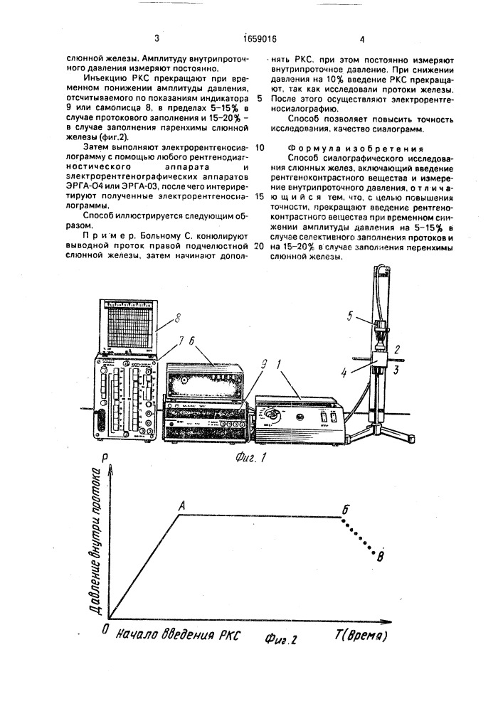 Способ сиалографического исследования слюнных желез (патент 1659016)