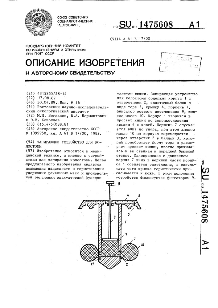 Запирающее устройство для колостомы (патент 1475608)